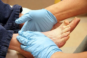 Diabetic foot treatment in the Midtown Manhattan, New York, NY 10036